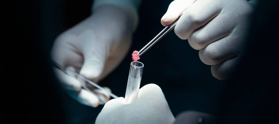 Biopsy Testing Clinic in Lilburn, Norcross, Sandy Springs, Stone Mountain, Duluth, Clarkston, and Suwanee GA