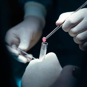 Biopsies Clinic in Lilburn Main, Lilburn Main Extension, Lilburn - Snellville, Norcross, Sandy Springs, Stone Mountain, Duluth, Clarkston, and Suwanee GA