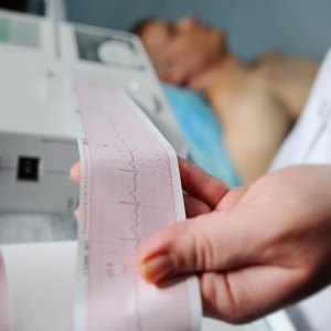 EKG Services in Lilburn Main, Lilburn Main Extension, Lilburn - Snellville, Norcross, Sandy Springs, Stone Mountain, Duluth, Clarkston, and Suwanee GA