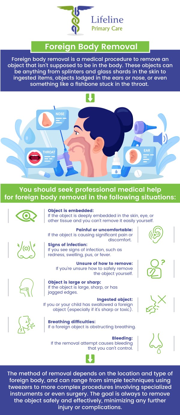 Foreign body removal is a medical procedure used to remove objects that have become lodged in the body, such as in the skin, eyes, ears, or respiratory tract. These objects can range from splinters and glass to more complex items like inhaled objects or swallowed items. At Lifeline Primary Care, Dr. Aziz Pirani, MD and Dr. Safia Pirani, MD use specialized tools and techniques to ensure that the removal process is quick, effective, and as comfortable as possible. For more information, contact us or request an appointment online. We have convenient locations to serve you in Lilburn Main, Lilburn Extension, Lilburn - Snellville, Norcross, Sandy Springs, Stone Mountain, Duluth, Clarkston, and Suwanee GA.