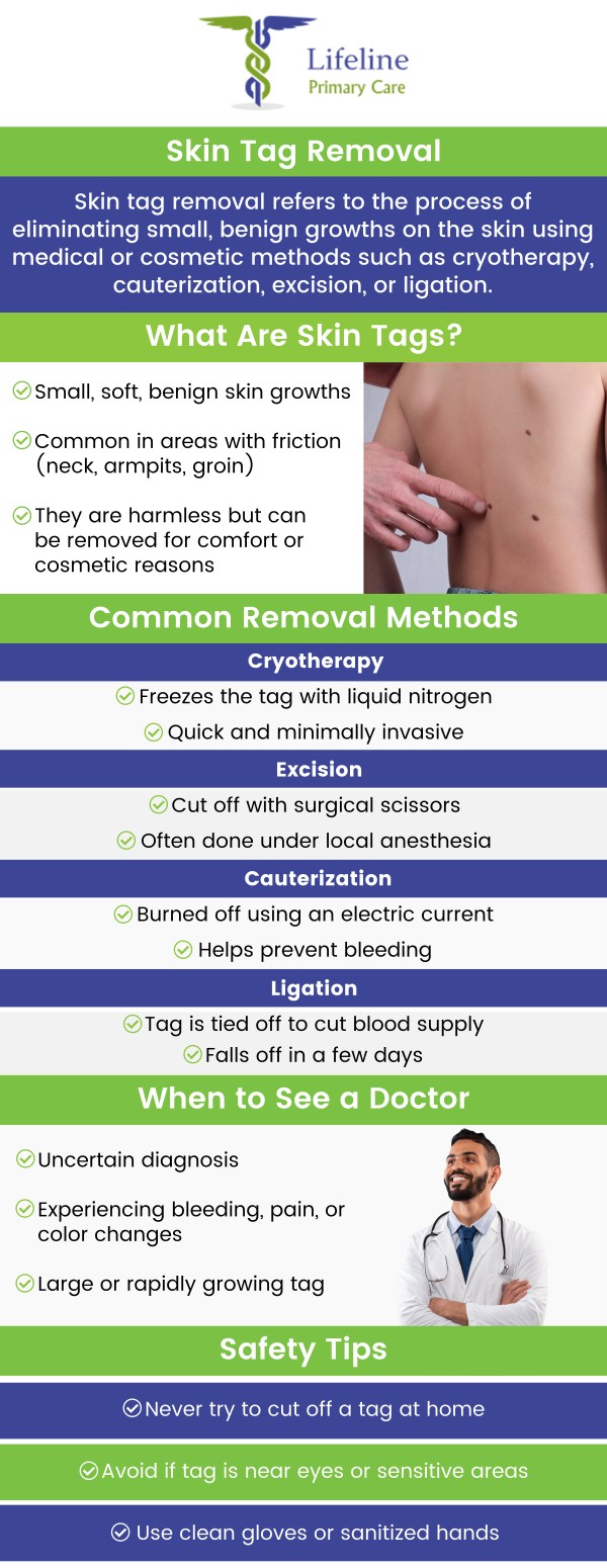 Common questions asked by patients: What is skin tag removal? Is skin tag removal safe? How is skin tag removal performed? Does skin tag removal hurt? For more information, contact us or request an appointment online. We serve patients from Lilburn Main GA, Lilburn Extension GA, Lilburn - Snellville GA, Norcross GA, Sandy Springs GA, Stone Mountain GA, Duluth GA, Clarkston GA, Suwanee GA, Tucker GA, Alpharetta GA, Sugar Hill GA, Scottdale GA, Decatur GA, Doraville GA, Dunwoody GA, Roswell GA, Chamblee GA, Redan GA, Gresham Park GA, Johns Creek GA, Buford GA, and surrounding cities.