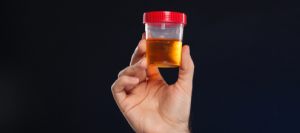 Urine Drug Test Clinic Near Me in Lilburn, Norcross, Sandy Springs, Stone Mountain, Duluth, Clarkston, and Suwanee GA Urine Drug Test Clinic Near Me in Lilburn, Norcross, Sandy Springs, Stone Mountain, Duluth, Clarkston, and Suwanee GA