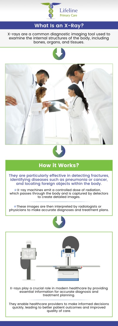 At Lifeline Primary Care, we provide high-quality X-ray services to assist in diagnosing a wide range of conditions. Our skilled providers use the latest technology to ensure accurate imaging, giving you fast and reliable results. For more information, contact us or request an appointment online. We have convenient locations to serve you in Lilburn Main, Lilburn Extension, Lilburn - Snellville, Norcross, Sandy Springs, Stone Mountain, Duluth, Clarkston, and Suwanee GA.