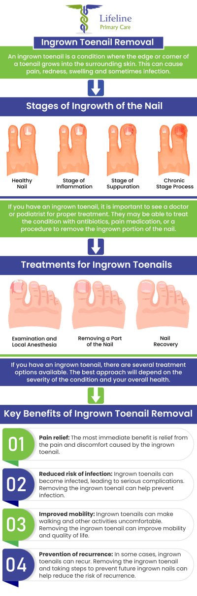 Common questions asked by patients: What is toenail removal? When is toenail removal necessary? How is toenail removal performed? Does toenail removal hurt? For more information, contact us or request an appointment online. We are conveniently located at 6328 Oakwood Circle, Suite A, Norcross, GA 30093. We serve patients from Norcross GA, Tucker GA, Lilburn GA, Peachtree Corners GA, Doraville GA, Johns Creek GA, Duluth GA, and surrounding areas.