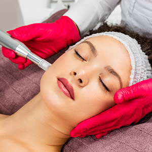 Microneedling with PRP in Duluth, GA