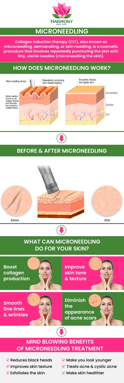 If you’re interested in improving acne scars or enhancing your skin’s overall appearance, schedule a consultation at Harmony Med Spa. Corinne Anthony, NP, and our team will evaluate your specific skin concerns and guide you through the microneedling process, ensuring your treatment is safe, comfortable, and tailored to your needs. For more information, contact us or request your appointment online today. We are conveniently located at 4855 River Green Pkwy #700B, Duluth, GA 30096.